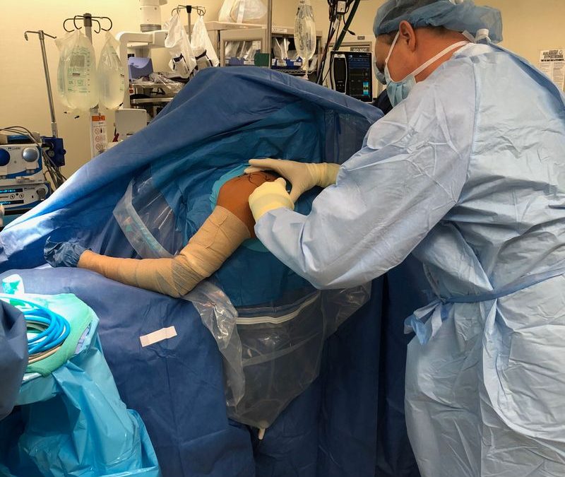 Arthroscopic Shoulder Surgery in West New York, NJ
